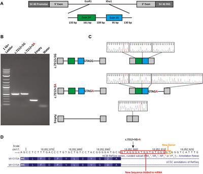 Identification of Novel and Recurrent Variants in MYO15A in Ashkenazi Jewish Patients With Autosomal Recessive Nonsyndromic Hearing Loss